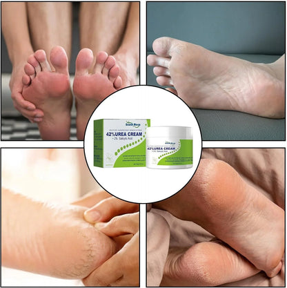 ساوث مون - كريم اليوريا 42% + حمض الساليسيليك 2% (الأصلي)